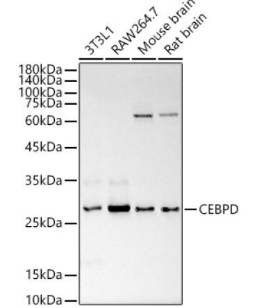 CEBP Delta/CEBPD Rabbit Polyclonal Antibody