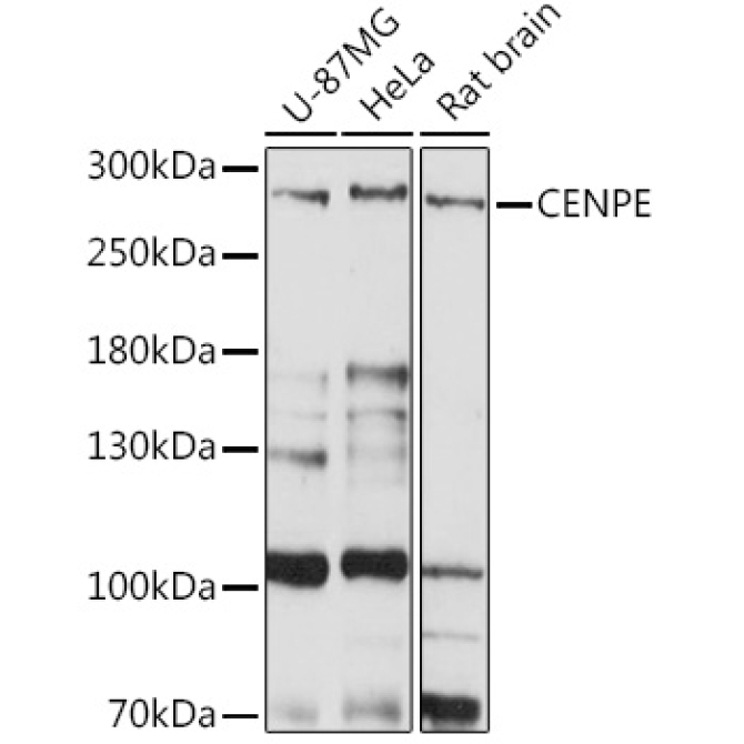 CENPE Rabbit Polyclonal Antibody