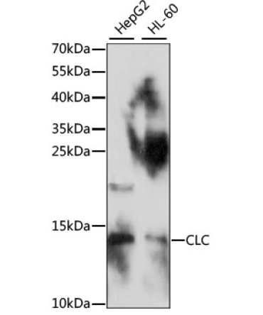 CLC Rabbit Polyclonal Antibody