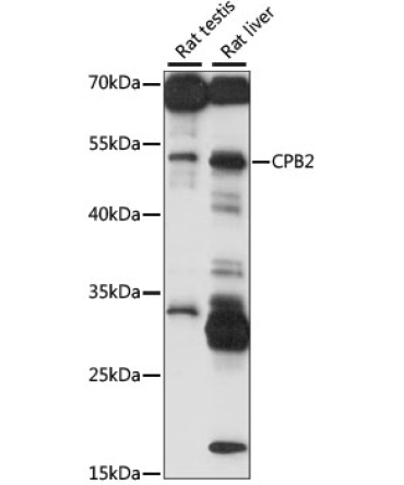 CPB2 Rabbit Polyclonal Antibody