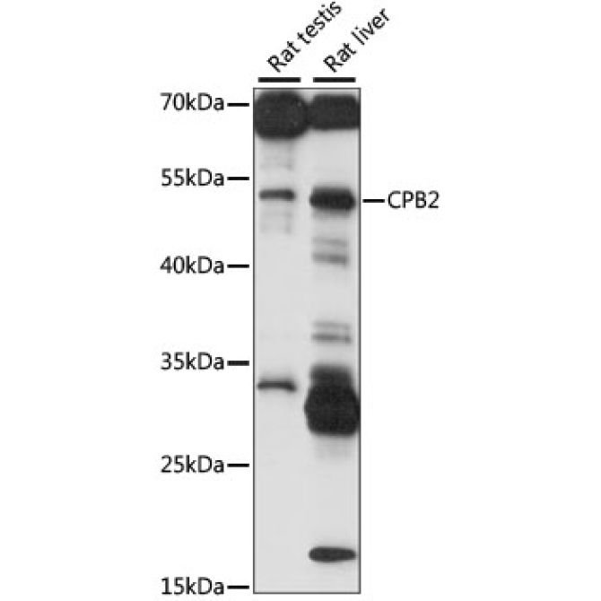 CPB2 Rabbit Polyclonal Antibody