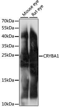 CRYBA1 Rabbit Polyclonal Antibody