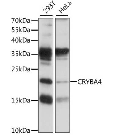 CRYBA4 Rabbit Polyclonal Antibody