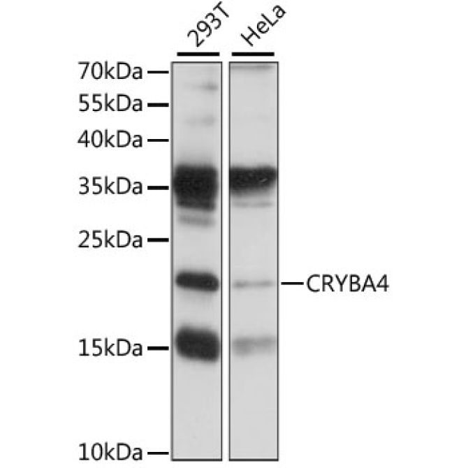 CRYBA4 Rabbit Polyclonal Antibody
