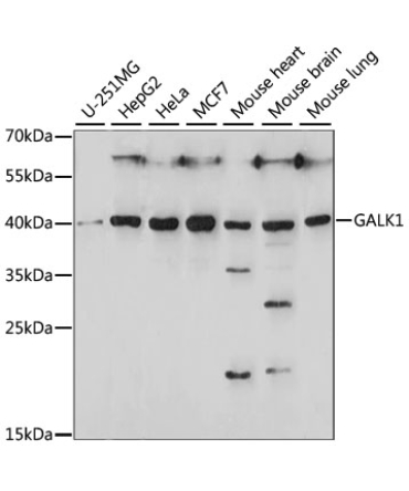 GALK1 Rabbit Polyclonal Antibody