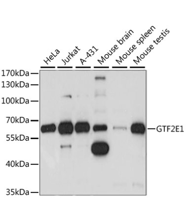 GTF2E1 Rabbit Polyclonal Antibody