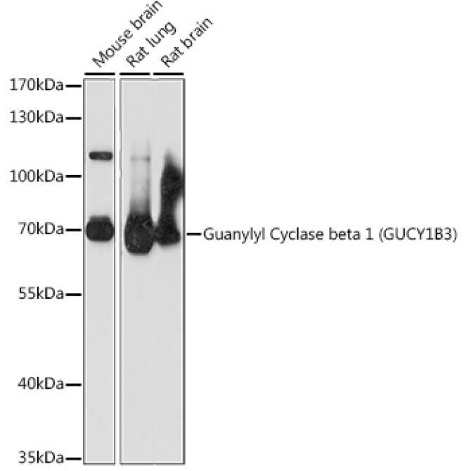 Guanylyl Cyclase beta 1 (GUCY1B3) Rabbit Polyclonal Antibody