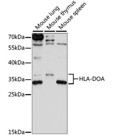 HLA-DOA Rabbit Polyclonal Antibody