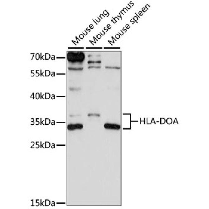 HLA-DOA Rabbit Polyclonal Antibody
