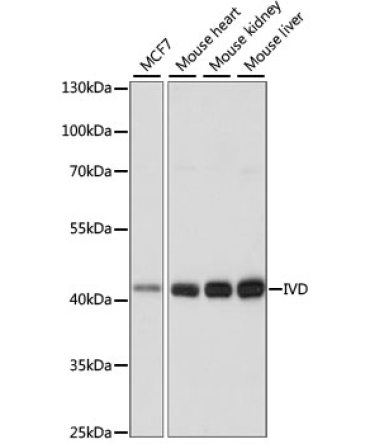 IVD Rabbit Polyclonal Antibody