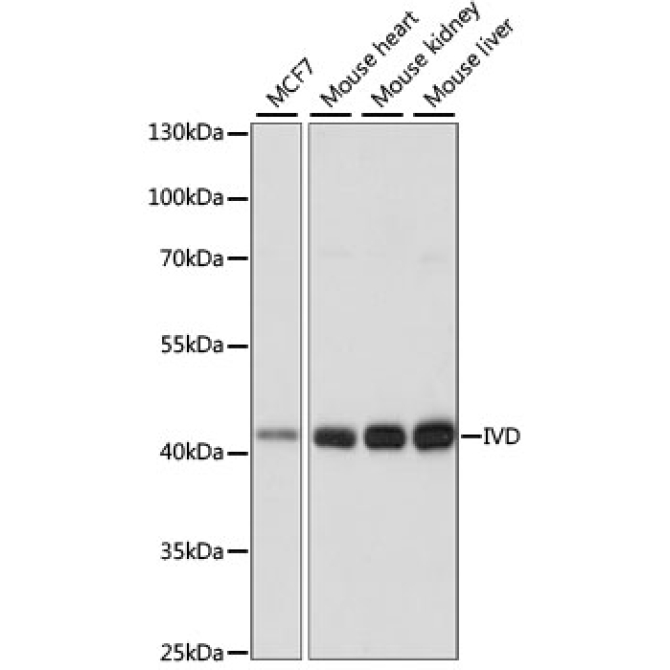 IVD Rabbit Polyclonal Antibody