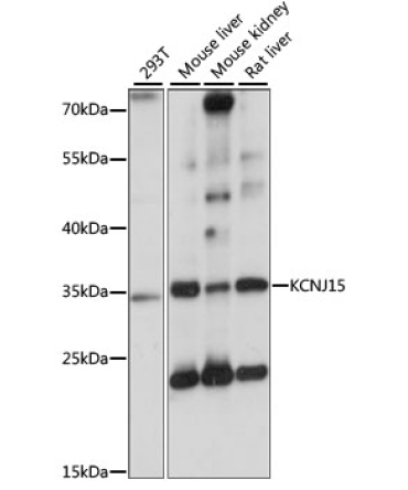 KCNJ15 Rabbit Polyclonal Antibody
