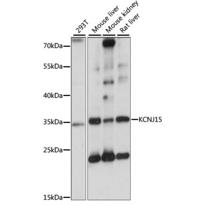 KCNJ15 Rabbit Polyclonal Antibody