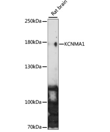 KCNMA1 Rabbit Polyclonal Antibody