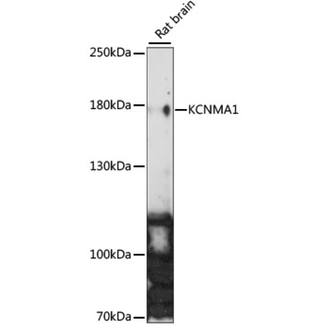 KCNMA1 Rabbit Polyclonal Antibody