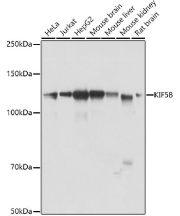 KIF5B Rabbit Polyclonal Antibody