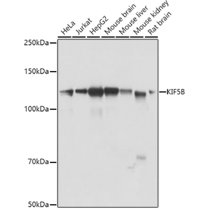 KIF5B Rabbit Polyclonal Antibody