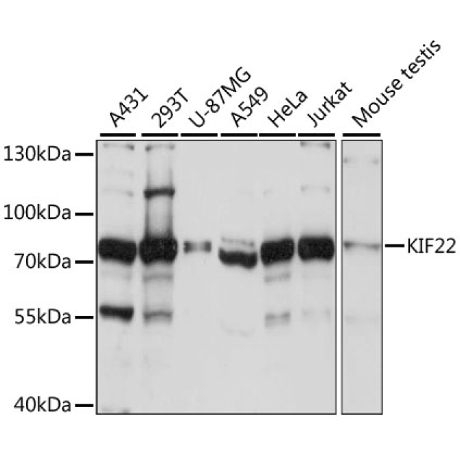 KIF22 Rabbit Polyclonal Antibody