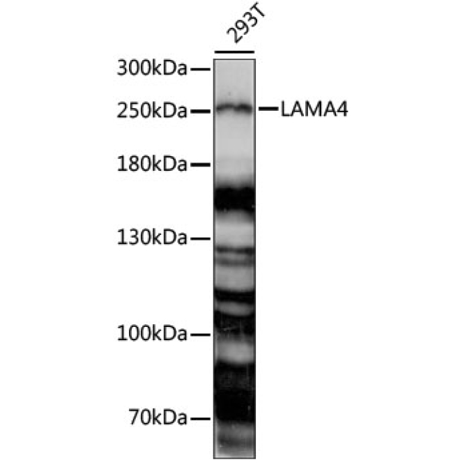 LAMA4 Rabbit Polyclonal Antibody