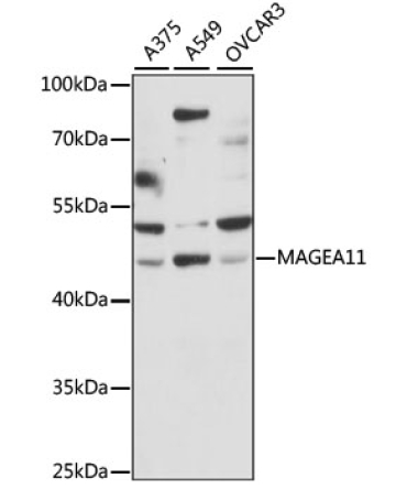 MAGEA11 Rabbit Polyclonal Antibody