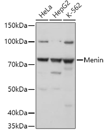 Menin Rabbit Polyclonal Antibody