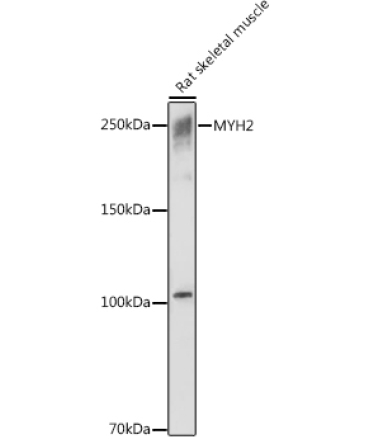 MYH2 Rabbit Polyclonal Antibody