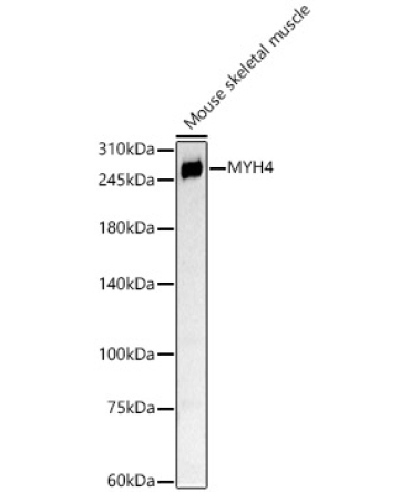 MYH4 Rabbit Polyclonal Antibody