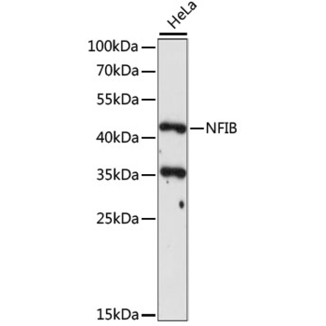 NFIB Rabbit Polyclonal Antibody