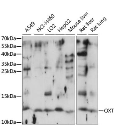 OXT Rabbit Polyclonal Antibody