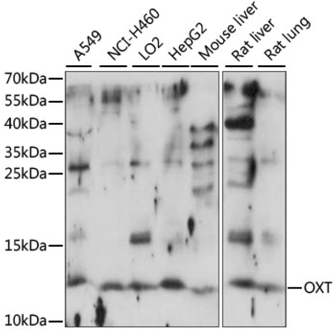 OXT Rabbit Polyclonal Antibody