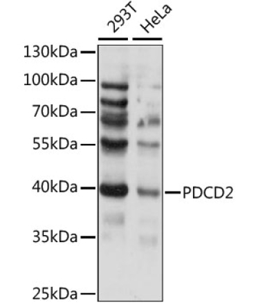 PDCD2 Rabbit Polyclonal Antibody