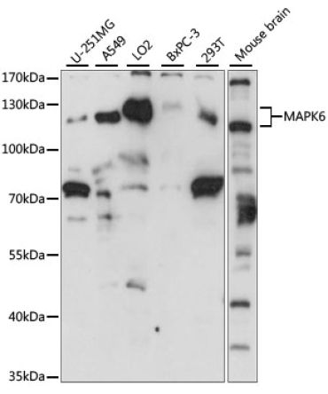 MAPK6 Rabbit Polyclonal Antibody