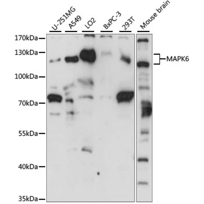 MAPK6 Rabbit Polyclonal Antibody
