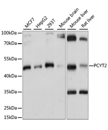 PCYT2 Rabbit Polyclonal Antibody