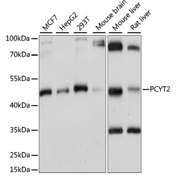 PCYT2 Rabbit Polyclonal Antibody
