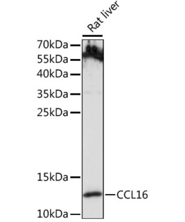 CCL16 Rabbit Polyclonal Antibody