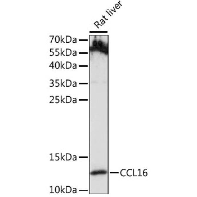 CCL16 Rabbit Polyclonal Antibody