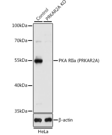 PKA RIIAlpha (PRKAR2A) Rabbit Polyclonal Antibody [KO Validated]