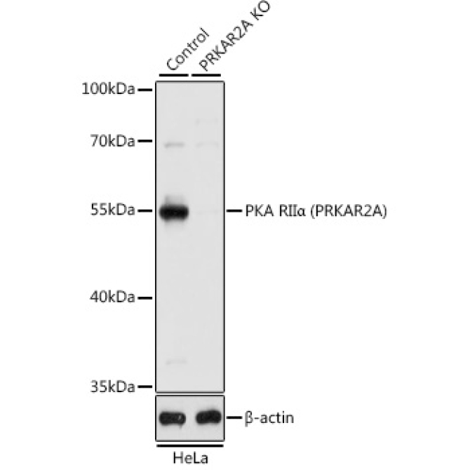 PKA RIIAlpha (PRKAR2A) Rabbit Polyclonal Antibody [KO Validated]