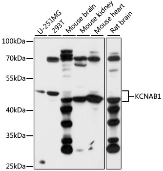 KCNAB1 Rabbit Polyclonal Antibody