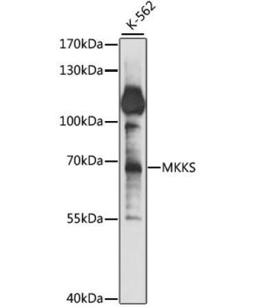 MKKS Rabbit Polyclonal Antibody