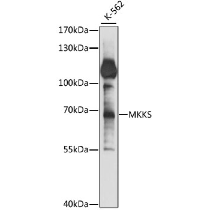 MKKS Rabbit Polyclonal Antibody