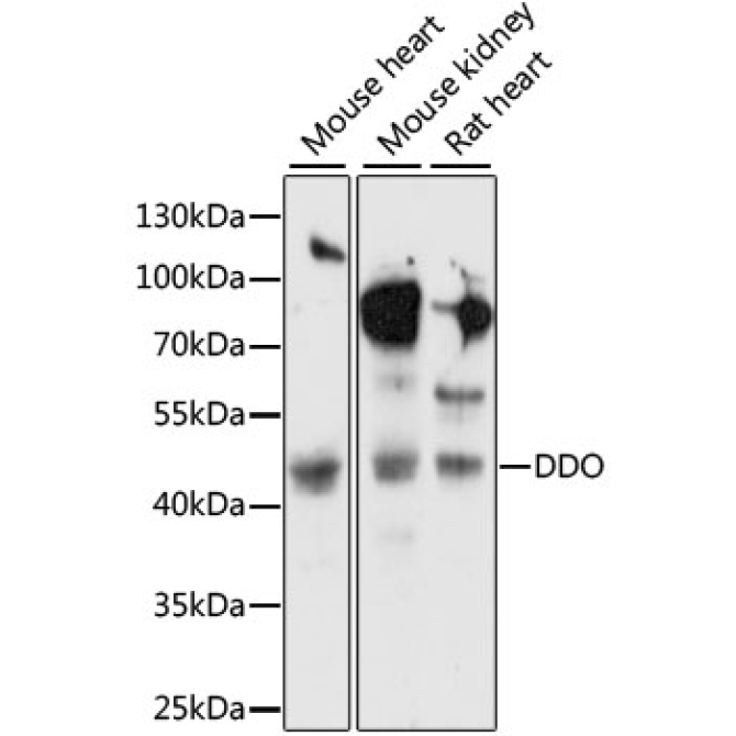 DDO Rabbit Polyclonal Antibody