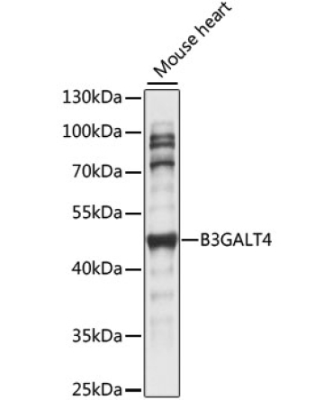 B3GALT4 Rabbit Polyclonal Antibody