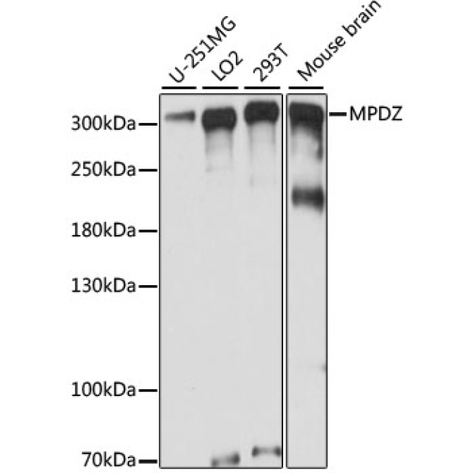 MPDZ Rabbit Polyclonal Antibody