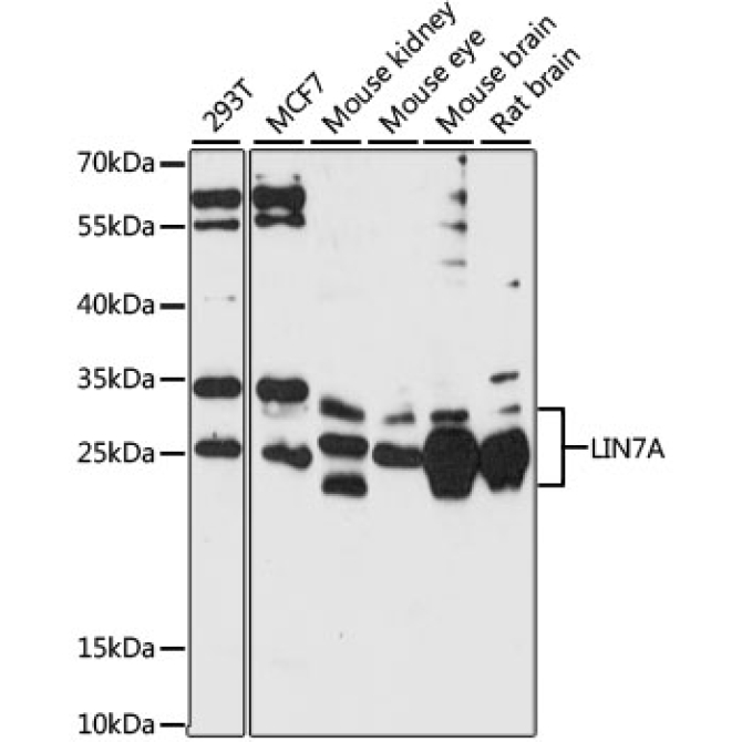 LIN7A Rabbit Polyclonal Antibody