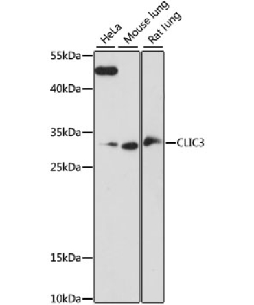 CLIC3 Rabbit Polyclonal Antibody