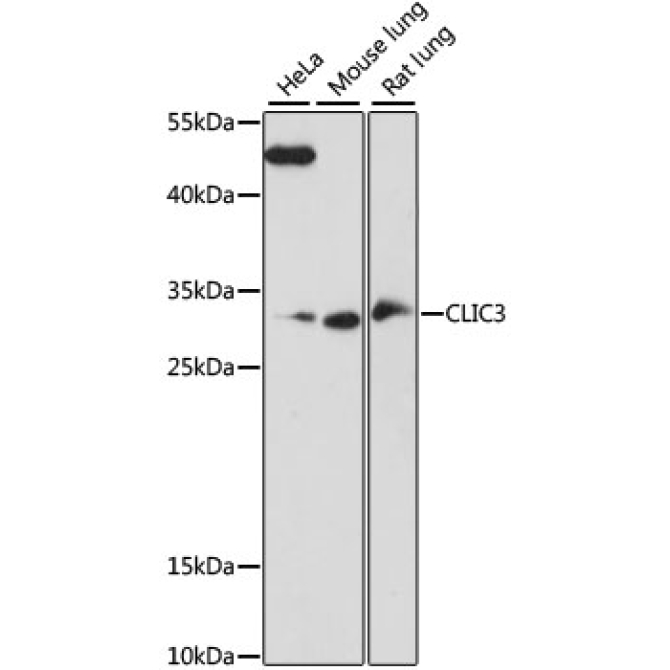 CLIC3 Rabbit Polyclonal Antibody