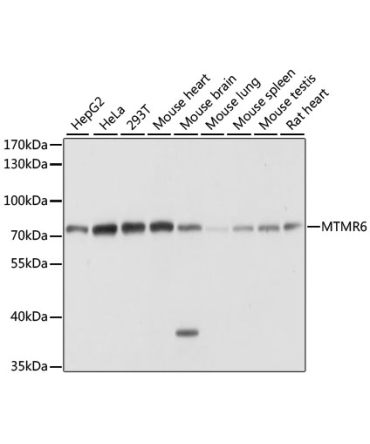 MTMR6 Rabbit Polyclonal Antibody