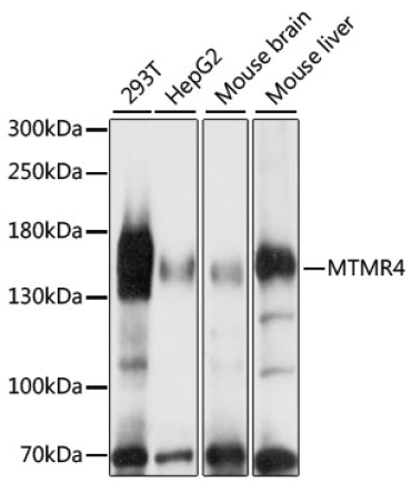 MTMR4 Rabbit Polyclonal Antibody